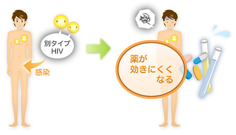 別タイプHIV 感染 薬が効きにくくなる