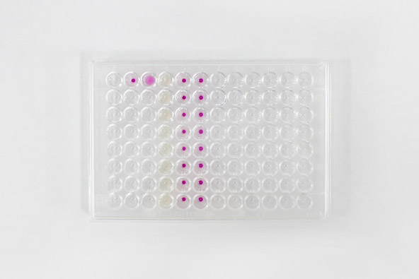 粒子凝集反応(PA法)