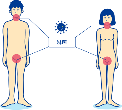 淋病の解説 症状や感染経路 検査や治療について Std研究所